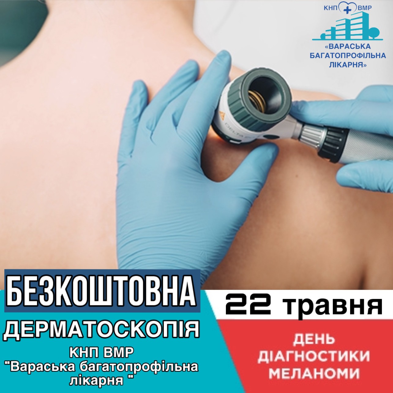 22 травня 2023 року в Україні відбудеться День діагностики меланоми