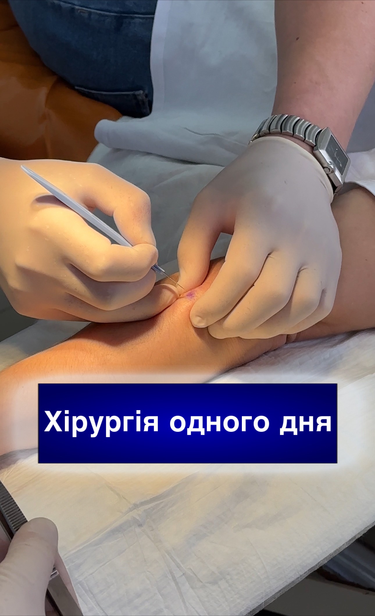 Хірургія одного дня Хірургія одного дня