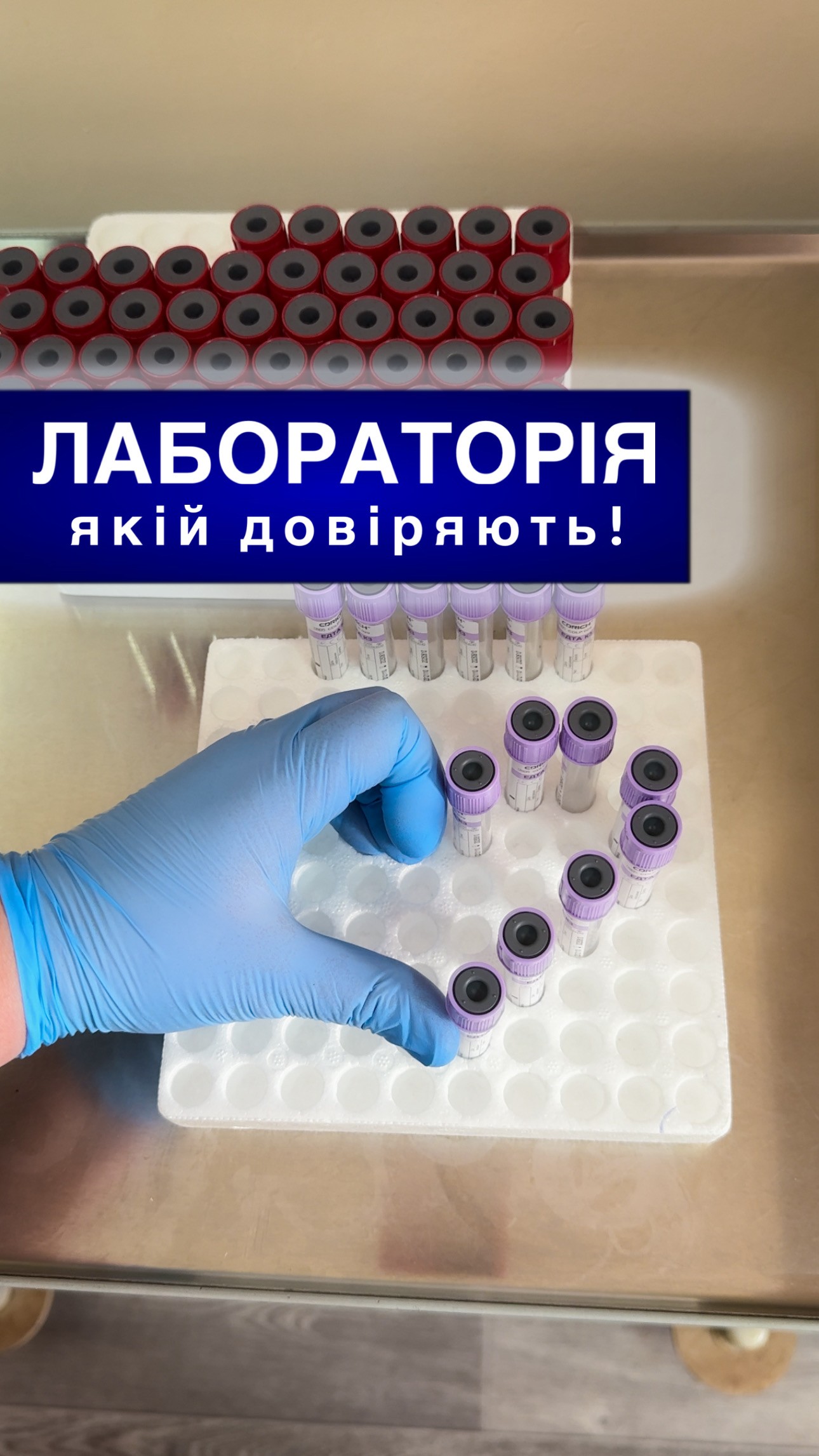 Чи можна здати аналізи у лікарні без електронного направлення? Чи можна здати аналізи у лікарні без електронного направлення?